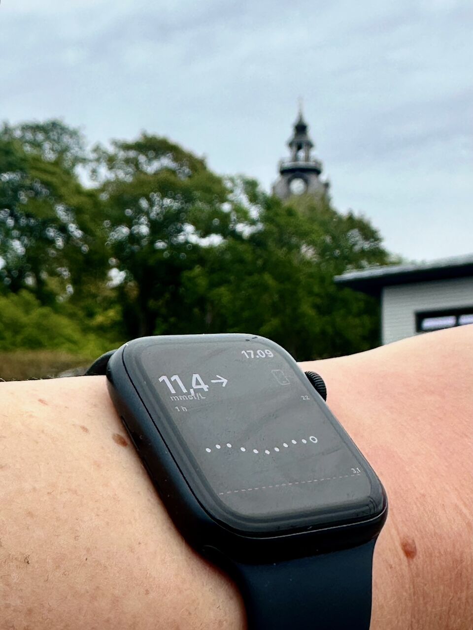 Glukoosiarvo Apple Watchissa