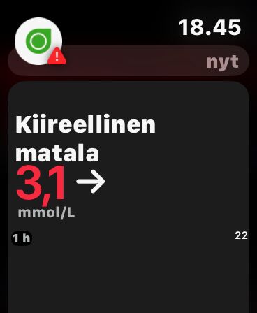 Kiireellinen matala -hälytys Apple Watchissa