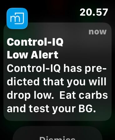 Control-IQ-hälytys Apple Watchissa