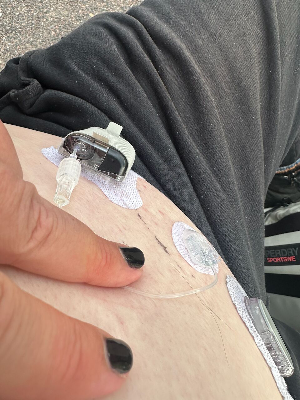 Tarrataskussa oleva Mobi käsivarressa