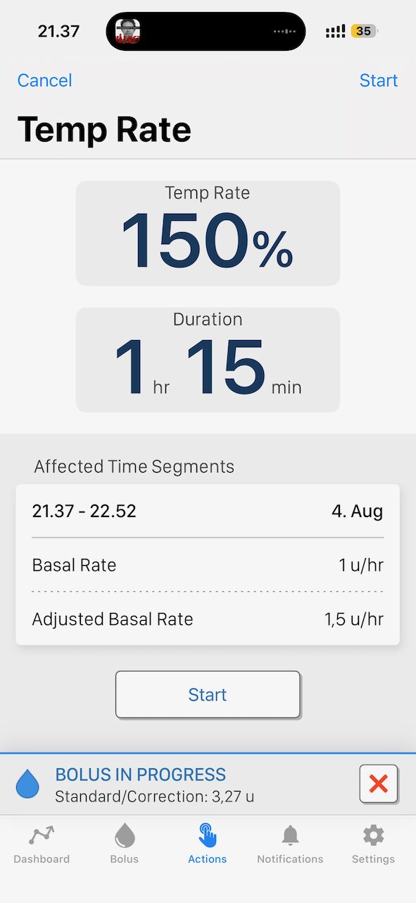 Väliaikainen basaali 150 % 1 h 15 min ajaksi